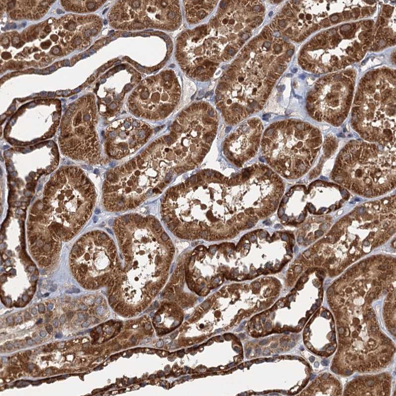 Anti-NLRP10 Antibody