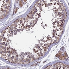 Anti-RNF17 Antibody