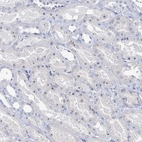 Immunohistochemical staining of human kidney shows moderate positivity in nucleoli in cells in tubules.