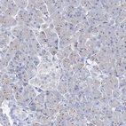 Immunohistochemical staining of human pancreas shows strong positivity in nucleoli in exocrine glandular cells.