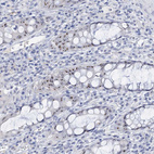 Immunohistochemical staining of human rectum shows strong positivity in nucleoli in glandular cells.