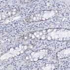 Immunohistochemical staining of human rectum shows strong positivity in nucleoli in glandular cells.