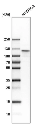Western blot analysis in human cell line NTERA-2.