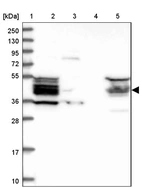 Lane 1: Marker [kDa] 250, 130, 95, 72, 55, 36, 28, 17, 10_br/_Lane 2: Human cell line RT-4_br/_Lane 3: Human cell line U-251MG sp_br/_Lane 4: Human plasma (IgG/HSA depleted)_br/_Lane 5: Human liver tissue