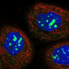 Immunofluorescent staining of human cell line A-431 shows localization to nucleoli.