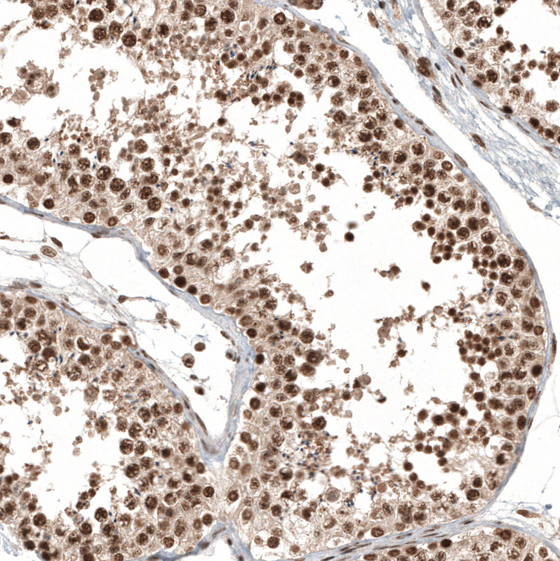 Anti-C11orf84 Antibody