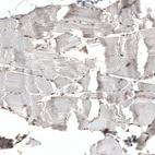 Immunohistochemical staining of human skeletal muscle shows very weak nuclear positivity in myocytes.