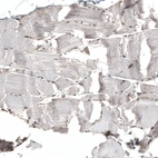 Immunohistochemical staining of human skeletal muscle shows very weak nuclear positivity in myocytes.