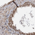 Immunohistochemical staining of human prostate shows strong nuclear positivity in glandular cells.