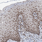 Immunohistochemical staining of human cervix, uterine shows strong nuclear positivity in squamous epithelial cells.