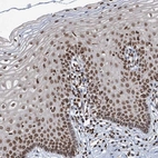 Immunohistochemical staining of human cervix, uterine shows strong nuclear positivity in squamous epithelial cells.