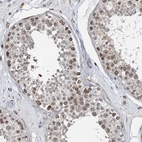 Immunohistochemical staining of human testis shows moderate nuclear positivity in cells in seminiferous ducts.