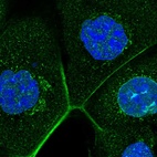 Immunofluorescent staining of human cell line A-431 shows localization to nuclear membrane, plasma membrane & actin filaments.