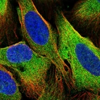 Immunofluorescent staining of human cell line U-2 OS shows localization to cytosol.