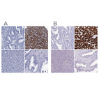 Immunohistochemical staining of human endometrium, heart muscle, pancreas and prostate using Anti-MYBPC3 antibody HPA040147 (A) shows similar protein distribution across tissues to independent antibody HPA043898 (B).