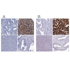 Immunohistochemical staining of human endometrium, heart muscle, pancreas and prostate using Anti-MYBPC3 antibody HPA040147 (A) shows similar protein distribution across tissues to independent antibody HPA043898 (B).