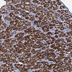 Immunohistochemical staining of human heart muscle shows strong cytoplasmic positivity in cardiomyocytes.