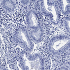 Immunohistochemical staining of human endometrium shows no positivity in glandular cells as expected.