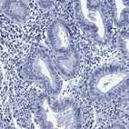 Immunohistochemical staining of human endometrium shows no positivity in glandular cells as expected.