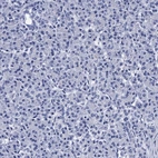 Immunohistochemical staining of human pancreas shows no positivity in exocrine glandular cells as expected.
