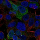 Anti-AMDHD1 Antibody