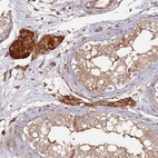 Anti-LACC1 Antibody