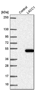 Western blot analysis in control (vector only transfected HEK293T lysate) and lACC1 over-expression lysate (Co-expressed with a C-terminal myc-DDK tag (~3.1 kDa) in mammalian HEK293T cells, LY407147).
