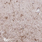 Immunohistochemical staining of human cerebral cortex shows strong cytoplasmic positivity in astrocytes.