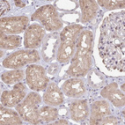 Immunohistochemical staining of human kidney shows strong cytoplasmic positivity in cells in tubules.