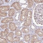 Immunohistochemical staining of human kidney shows strong cytoplasmic positivity in cells in tubules.