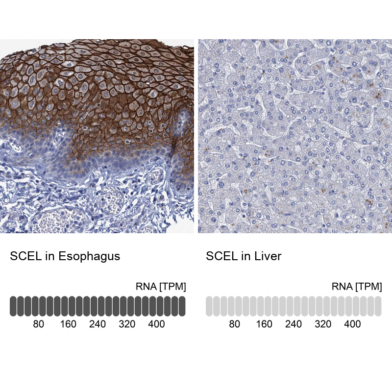 Anti-SCEL Antibody