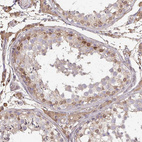 Immunohistochemical staining of human testis shows strong cytoplasmic positivity in Sertoli cells.