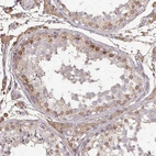 Immunohistochemical staining of human testis shows strong cytoplasmic positivity in Sertoli cells.