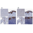 Immunohistochemical staining of human liver, skin, testis and tonsil using Anti-SCEL antibody HPA040154 (A) shows similar protein distribution across tissues to independent antibody HPA039737 (B).