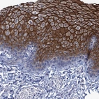 Immunohistochemical staining of human esophagus shows strong membranous positivity in squamous epithelial cells.