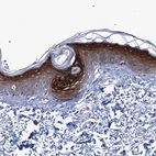 Immunohistochemical staining of human skin shows moderate to strong cytoplasmic and membranous positivity in squamous epithelial cells.