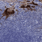 Immunohistochemical staining of human tonsil shows strong cytoplasmic and membranous positivity in squamous epithelial cells.