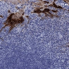 Immunohistochemical staining of human tonsil shows strong cytoplasmic and membranous positivity in squamous epithelial cells.