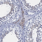 Immunohistochemical staining of human testis shows weak cytoplasmic positivity in Leydig cells.