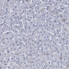 Immunohistochemical staining of human liver shows no positivity in hepatocytes as expected.
