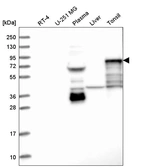 Western blot analysis in human cell line RT-4, human cell line U-251 MG, human plasma, human liver tissue and human tonsil tissue.