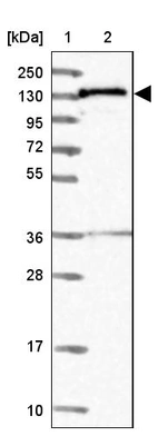 Lane 1: Marker [kDa] 250, 130, 95, 72, 55, 36, 28, 17, 10_br/_Lane 2: Human cell line RT-4