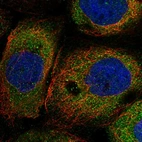 Immunofluorescent staining of human cell line A-431 shows localization to cytosol.