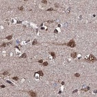 Immunohistochemical staining of human cerebral cortex using Anti-CSTF3 antibody HPA040168.