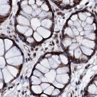 Immunohistochemical staining of human colon using Anti-CSTF3 antibody HPA040168.