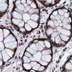 Immunohistochemical staining of human colon using Anti-CSTF3 antibody HPA040168.