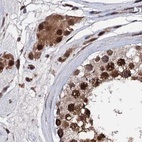 Immunohistochemical staining of human testis using Anti-CSTF3 antibody HPA040168.