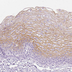 Immunohistochemical staining of human esophagus shows moderate membranous positivity in squamous epithelial cells.