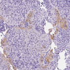 Immunohistochemical staining of human tonsil shows moderate membranous positivity in squamous epithelial cells.