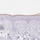 Immunohistochemical staining of human skin shows moderate membranous positivity in squamous epithelial cells.